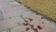مجهولون يعتدون بالضرب على شاب في رام الله